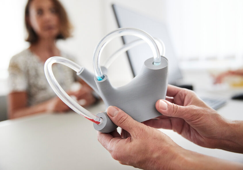 Schwindel horizontaler Bogengang